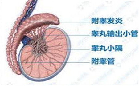 睾丸炎