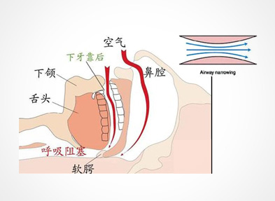 打呼噜