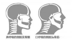 <b>鼻炎久拖不治，可能会“毁容”！</b>