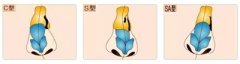 <b>鼻中隔偏曲有什么信号提示？</b>